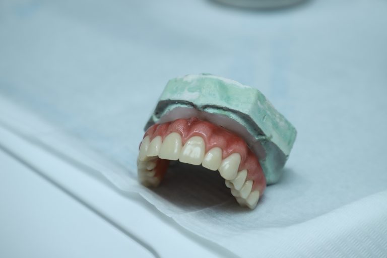 Prótese dentária sobre superfície clínica